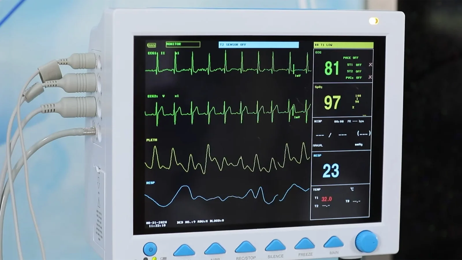 Backdoor found in two healthcare patient monitors, linked to IP in China