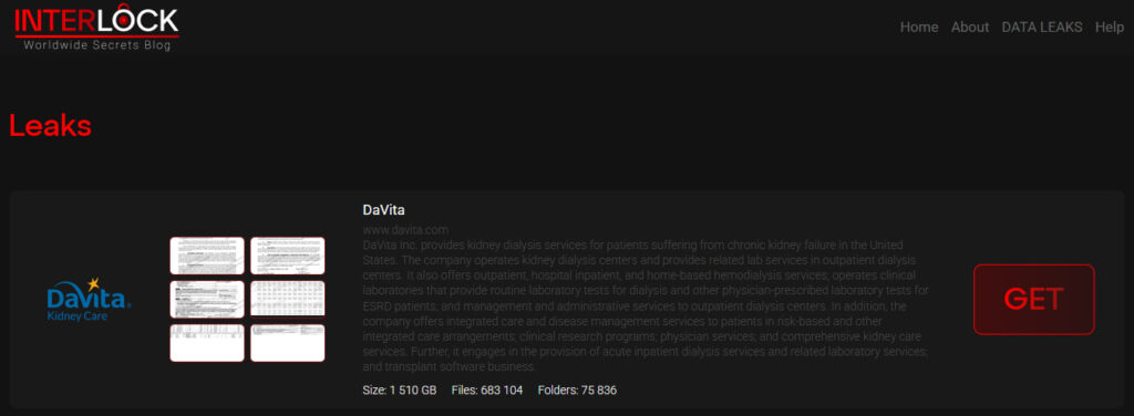 InterLock DaVita leak